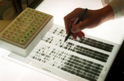 Untersuchung eines genetischen Fingerabdrucks