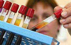 Serologisches Labor mit Blutprodukten in Reagenzgläsern