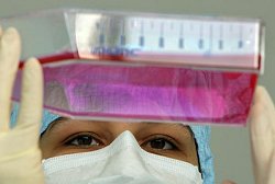 Im Hochleistungs-Sterillabor der Universität Leipzig kontrolliert eine Medizinisch Technische Assistentin Stammzellen, die für eine Behandlung der Patienten kultiviert werden.