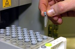 In einem molekularbiologischen Analytiklabor werden die Proben eines Vaterschaftstest zur Analyse vorbereitet.