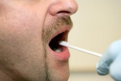 Ein Polizist führt ein Wattestäbchen in den Mund eines Mannes um eine Speichelprobe zu nehmen.