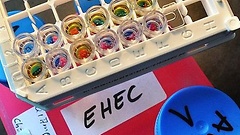 EHEC-Toxin-Suchtest